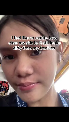 #fyppppppppppppppppppppppp #fy #f #trend #insecure #freckles 