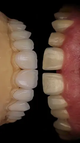 Animated Dental Photography video #dentalphotography #dental #dentistry #dentist #dentalhygienist 