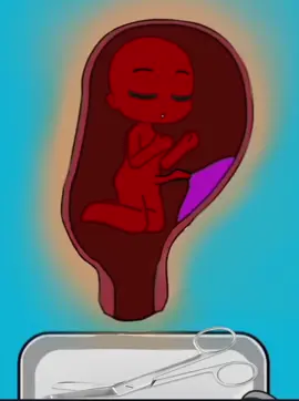 #gacha #pregnant #furry #fyp #meme 