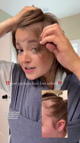 I can’t stop singing the praises of @Divi Scalp & Hair Health scalp serum. It works so well and the proof is in the pudding!! #postpartumhairloss #postpartumhair #postpartumhairgrowth #postpartumhairshedding #postpartum 