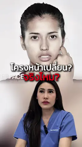 ถอนฟันตอนจัดฟันส่งผลทำให้หน้าเปลี่ยนจริงไหม? #จัดฟันใส #จัดฟัน #จัดฟันหน้าเปลี่ยน #จัดฟันเหล็ก #จัดฟันใสcrystalsmile 