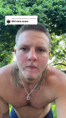 Replying to @Phantomhive thanks girly #ftm #trans #scarcare #topsurgery #transgender 