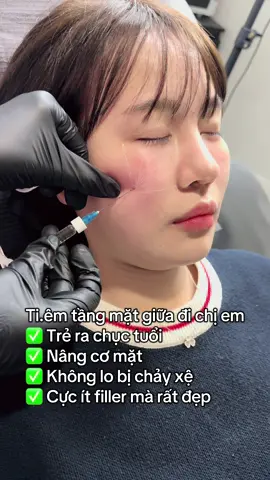 Nâng tầng mặt giữa . 1 dịch vụ mà hot hòn họt nhất năm 2025