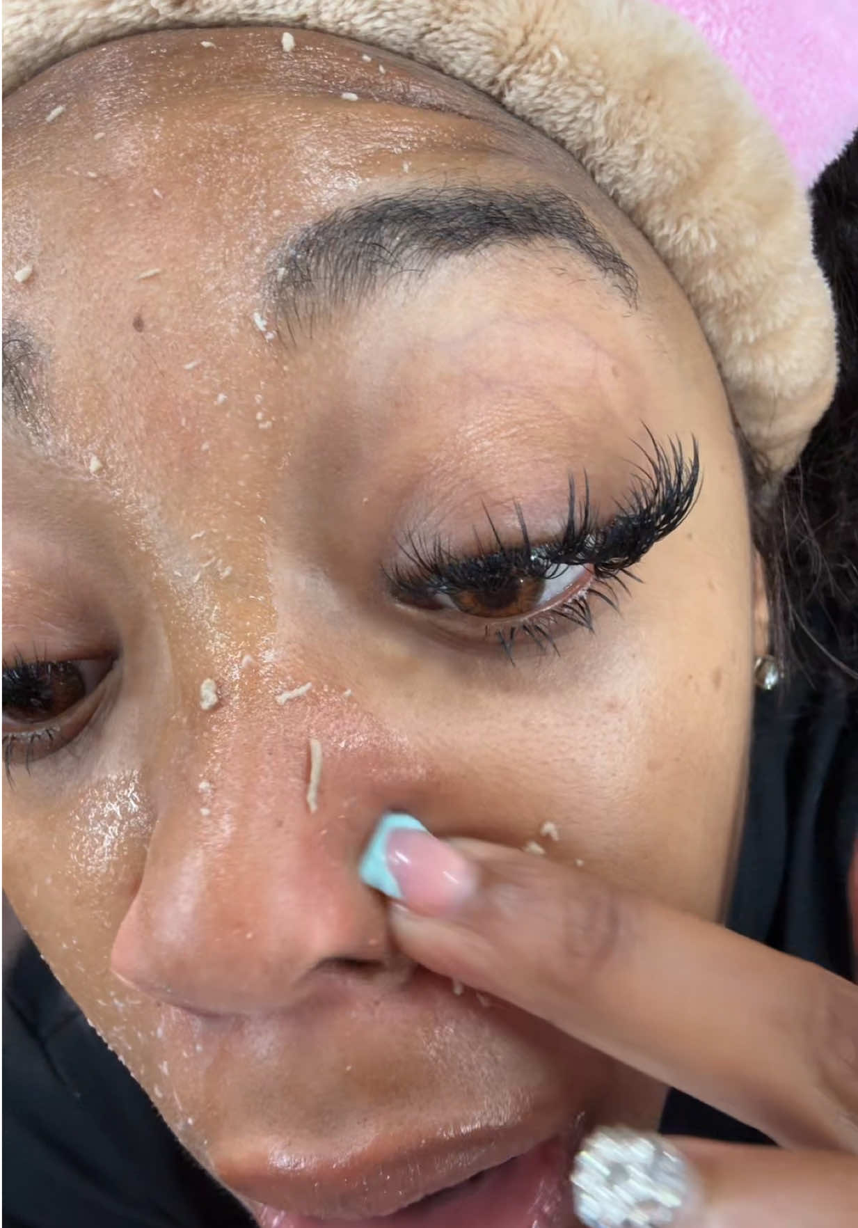 EWWW!!! Yall need to get this asap !! Thank me later !!! #drmelaxinpeelshot #skinroutine #fyp #deadskin #skincare 