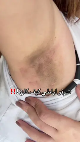 النتايج 😱😱🔥 #عشبة_وزيت #عناية #العناية_بالجسم #اكسبلوررر #اكسبلوررر 