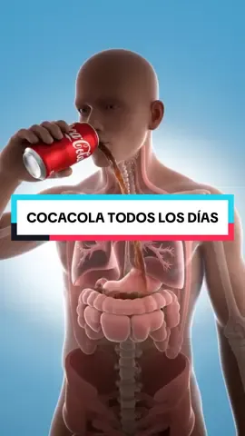 🥤 ¿Qué pasa si tomas coca todos los días? 1️⃣ Panza chelera exprés. 2️⃣ Dientes alv, caries seguras. 3️⃣ Riesgo de cáncer por el colorante. 4️⃣ Riñones y huesos jodidos. 5️⃣ Azúcar descontrolada como montaña rusa. 👉 La coca no refresca, te destruye lento. Comenta remedios y síguenos para optimizar tu salud. #cocacola #coke #salud 