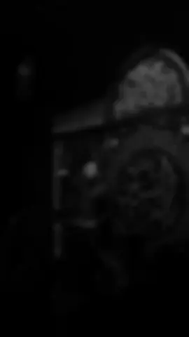 اليوم يوم ام الكمر 💔#يارب ##سبحان_الله_وبحمده_سبحان_الله_العظيم #شور_حتى_الظهور #اهل_البيت_عليهم_سلام #سيد_فاقد 