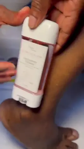 This Niacinamide Ceramide Foot Cream left my feet feeling smooth #tiktokshop  #footcare #skincare #feet #fyp 