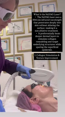 Láser facial rejuvenation 