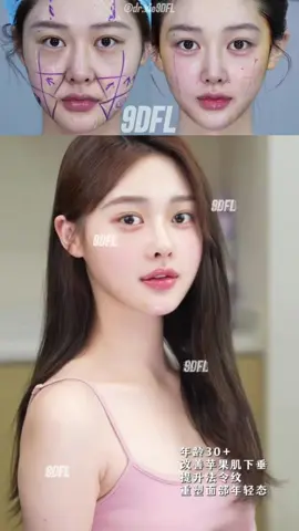 #9Dfacelift#beauty#beforeandafter #antiaging #babyface            