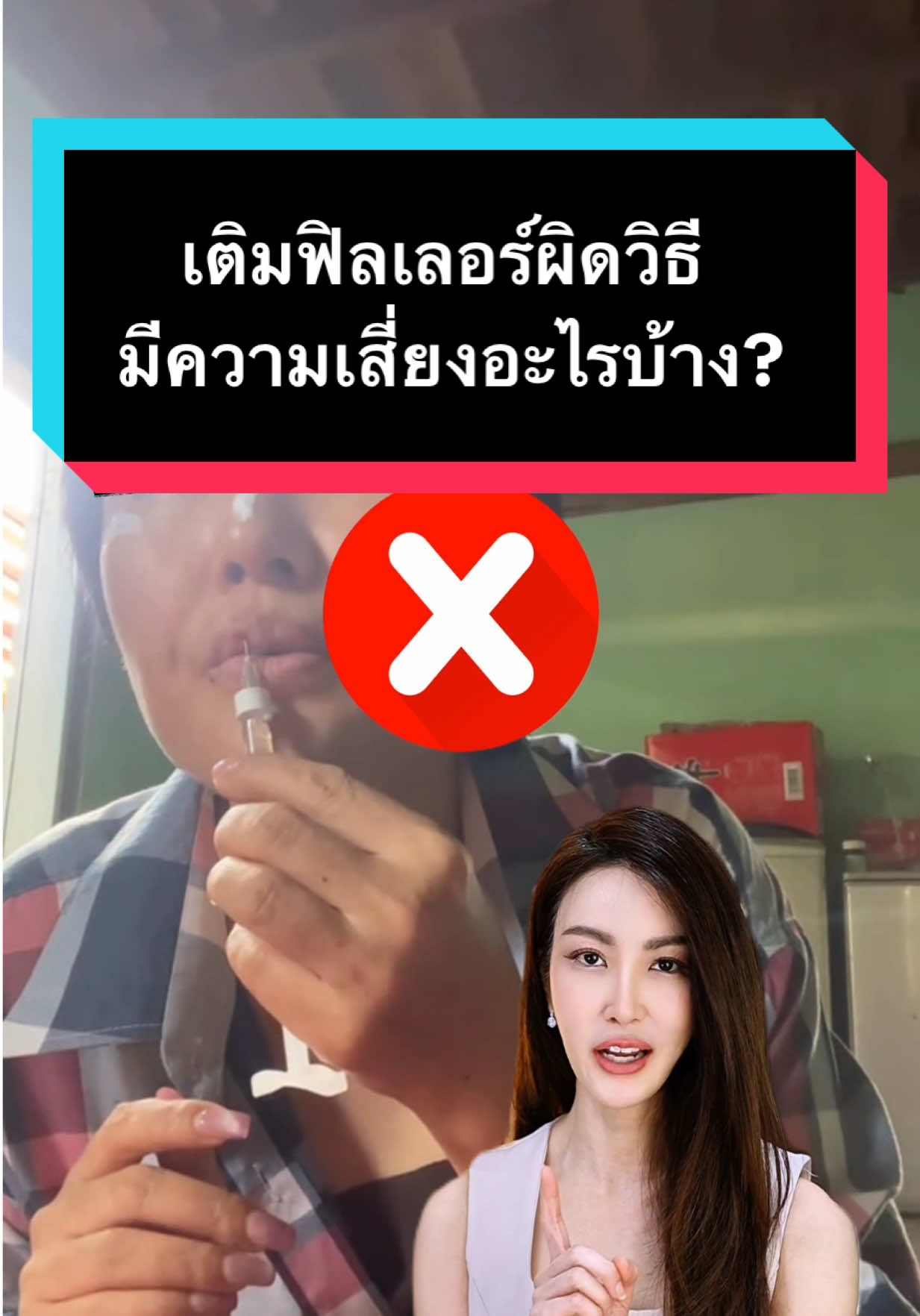 เติมฟิลเลอร์ผิดวิธีมีความเสี่ยงอะไรบ้าง? #พี่หยกforeveryoung #skindreamclinic #filler #ฟิลเลอร์ #อย่าหาทํา 