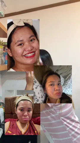 Iba din talaga ang natulong sakin.🥹💕 #ygb #beautywhitesoap #youglowbabe #ygbbeautywhite #tiktok #viral 