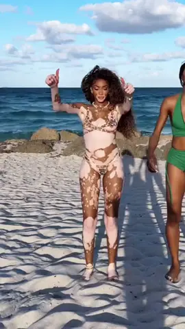She is not sad about her skin, but is very confident in showing herself! #explore #world #news #usa #winnieharlow