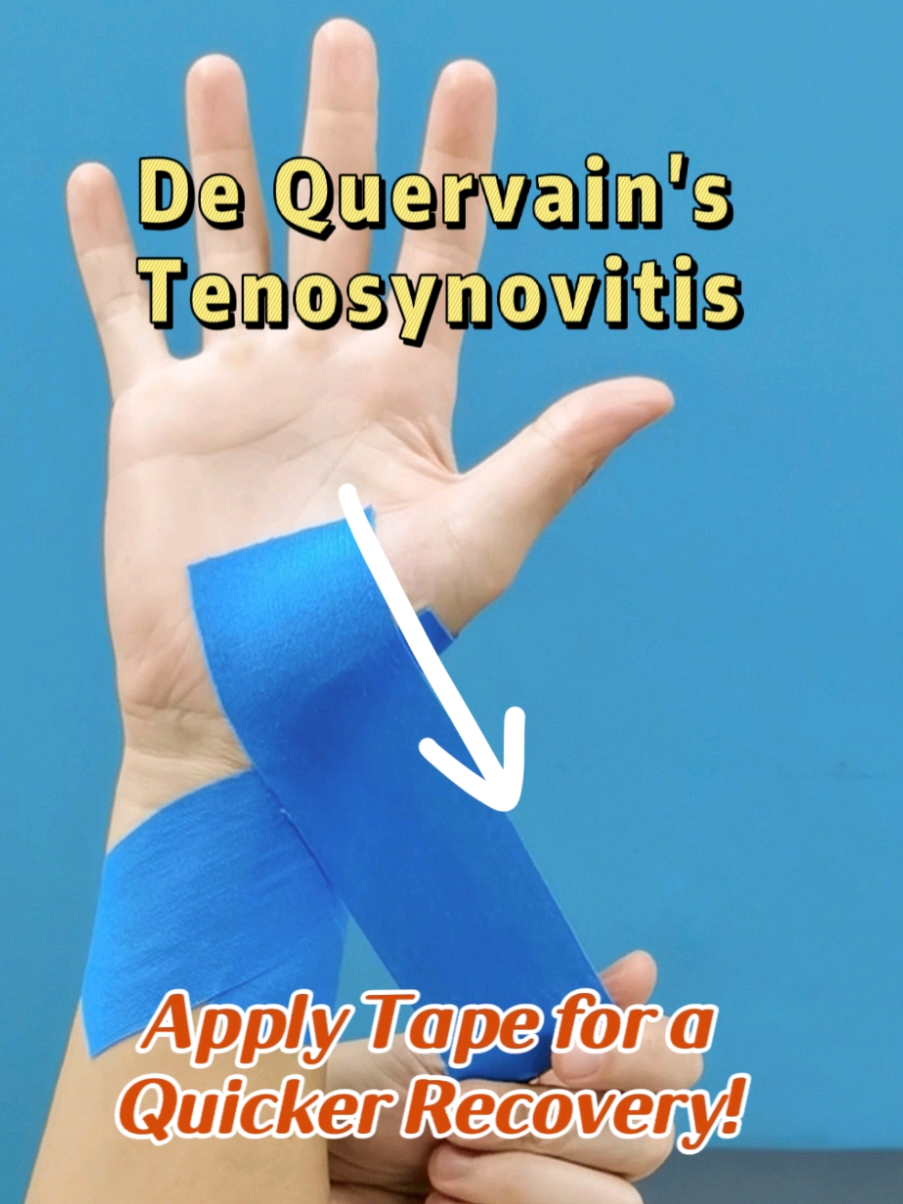 Simple Taping Method for De Quervain's Wrist/Thumb Injury. #dequervain #dequervainstenosynovitis #thumbpain #wristpain #kttape 