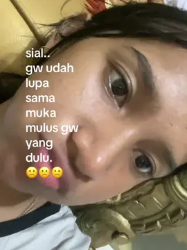 terakhir mulus kapan ya??#4u #fyp #jerawat #mulus#beruntusan 