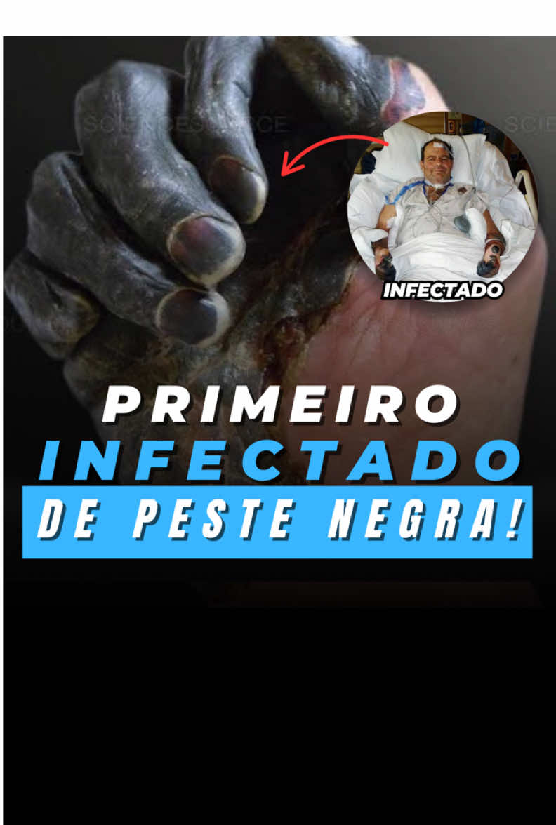 Peste Negra nós EUA é real? #eua #pestenegra #apocalipse #cavaleiroamarelo #fimdostempos 