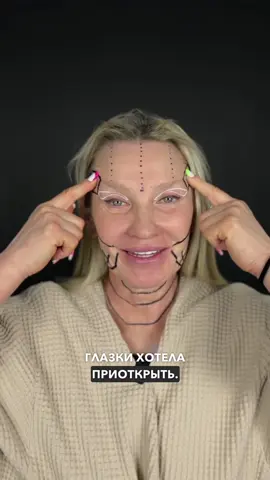 Гиперактивная Эльмира Хочет на 10 лет моложе 🔥 Ещё ранний результат, но посмотрите как она сияет уже на 14 сутки! ❓ результат на 1 и 14 сутки после комплексного омоложения. Как вам? Пациентка сохранная в стабильном весе. 2 года искала своего доктора. Из косметологии, в лице есть нити и аппаратная косметология.  Я сделал: 👉🏻 Фейслифтинг - операция по удалению избытков кожи лица и шеи, а также перемещение SMAS-структуры в новое положение. Платизмопластика. Липосакция шеи, подбородка. 👉🏻Верхнюю блефаропластику 👉🏻Лобно-височный лифтинг  ✔️Глазки открылись, помолодели ✔️Овал лица преобразился ✔️Устранили первичные признаки старения. ✔️Носогубные и губоподбородочные складки подразгладились. ✔️Эффект от операции прослужит долгие годы. ▪️Лицо выглядит моложе, гармоничнее. Этот эффект сохраняется продолжительное время – около 10 лет. ❗️Больше работ до/после в моём аккаунте.  ❗️Возможна операция в кредит ___________________________________ ⚜️ЕСТЕСТВЕННАЯ КРАСОТА | ДОКТОР АБРАМЯН С.М. 📞Запись на консультацию в Direct