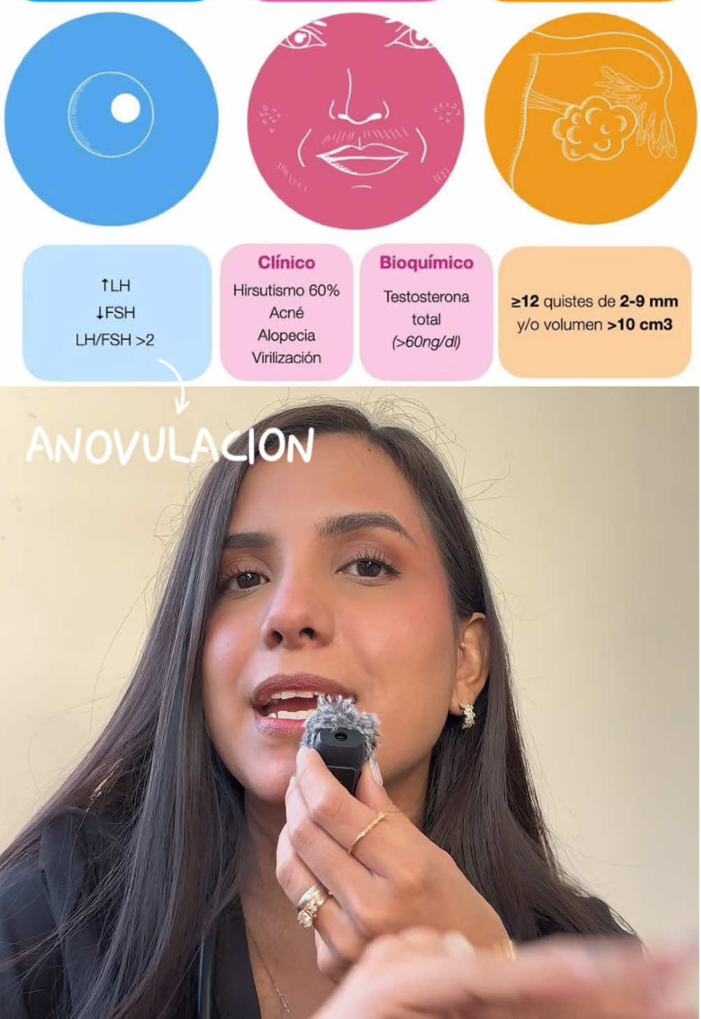 Cuál de estas señales tienes?🤔 importante recalcar que con 2 de los 3 criterios, ya se puede hacer el diagnóstico💓 consúltalo con tu gine👩🏽‍⚕️ #anticonceptivos #ginecologia #salud 