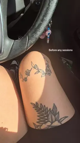 6x sessions deep 😭😭 maybe it will go one day 🙃 #tattooremoval #tattoos #tattoo #lasertattooremoval  #fyp 
