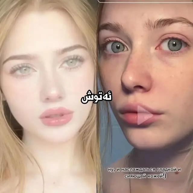 #il_rain_ #kurd #foryou #fyp #kurdistan #plasticsureon #fakebeauty 