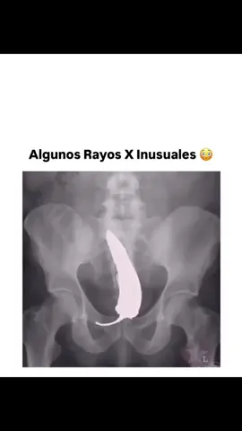 POV: Eres readiologo.  -¿qué es lo primero que se te viene a la mente? 💀💀💀 - - - - #explicandobiomedicina #biomedicina #medicina #ciencia #parati 