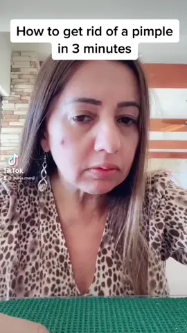 How to get rid of a pimple in 3 min #fyp #foyou #LifeHack #foryou 