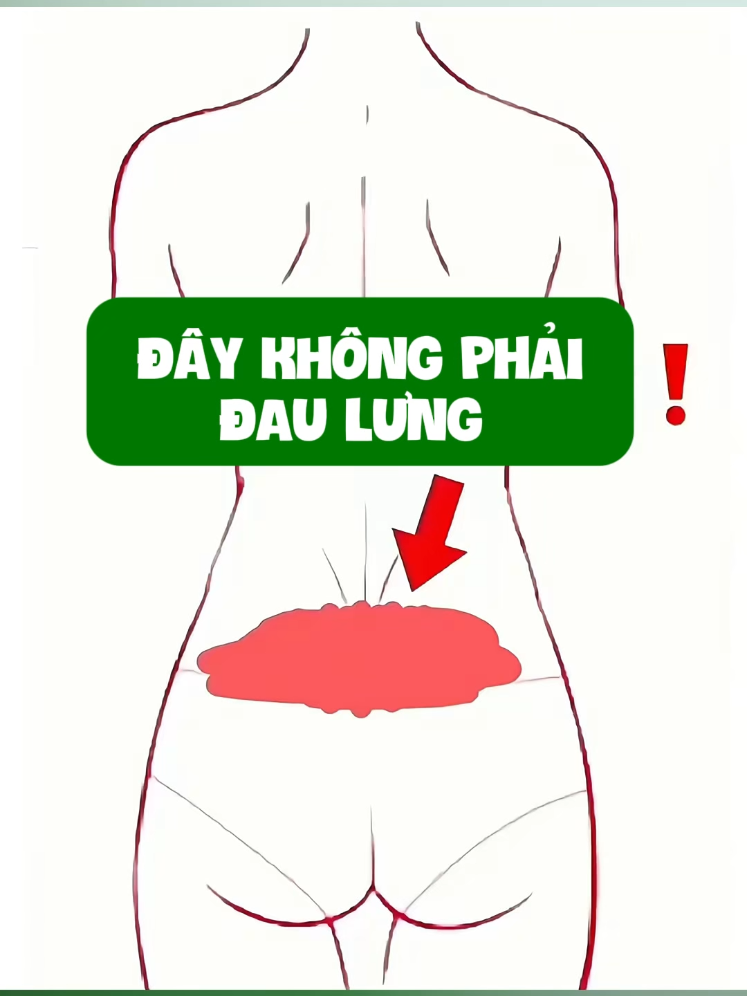 Đau ở đây! Bạn phải chú ý nhé. Nhiều người nghĩ rằng đau ở đây là đau lưng. Thực ra, đây là vấn đề của khớp cùng chậu. Phần lớn nguyên nhân là do ngồi sai tư thế và ngủ không đúng cách. Chia sẻ với bạn hai động tác, Nếu kiên trì thực hiện trong một tuần, chắc chắn bạn sẽ thấy cải thiện 😘  #wealthyhealth #hangchinhhang #suckhoe #thoaihoakhop #xuongkhop #daulung