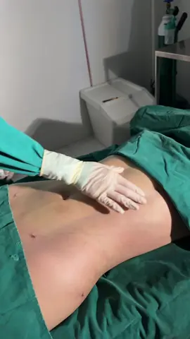 ดูดไขมันเหมาท้อง+ ร่อง11  🩷 ที่ภูม่า คลินิก 🩷 #ดูดไขมัน #ภูม่าคลินิก #phumaclinic #หมอหนูใหม่ #phumaclinic                   