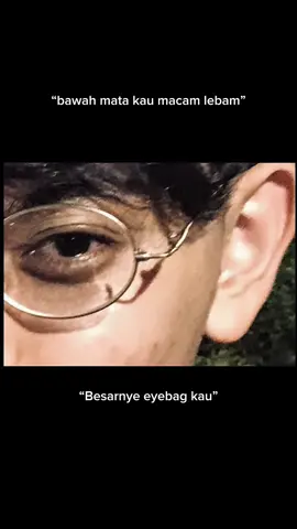 pakai setiap malam sebelum tidur memang bestt ! 🥹✨ #eyebag 