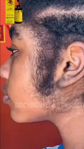 #ethiopian_tik_tok🇪🇹🇪🇹🇪🇹🇪🇹 #ኑር #noor #hair growth 