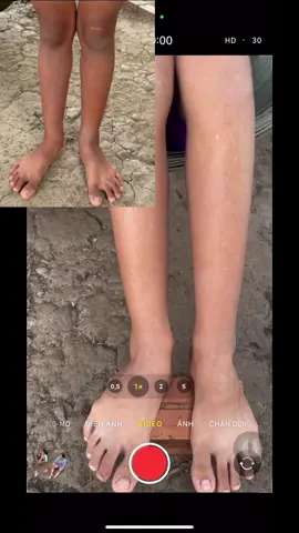 30 ngày từ cái da ngâm đen thâm luôn mà lên được nhiêu tông đó còn muốn gì nữa , sài kem trộn muốn trắng thì cũng mấy tháng tới 1 năm chứ sài 30 ngày đồ trắng đâu ra #kemtrontrangda #kem #kemtửa #thuynguyen706 #kemtronmientay 