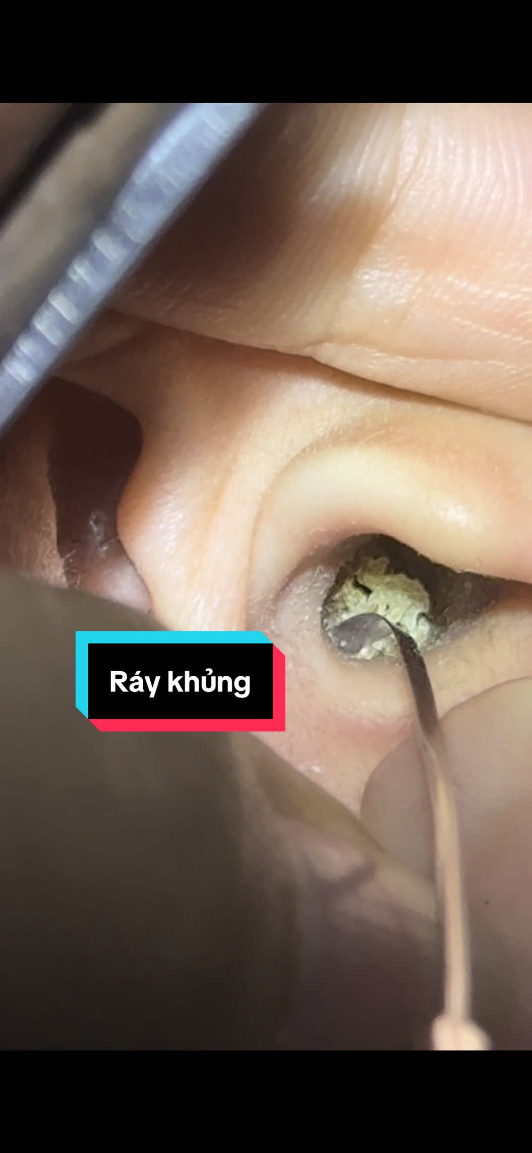 Ráy khủng#layraytai #xuhuong #viral 