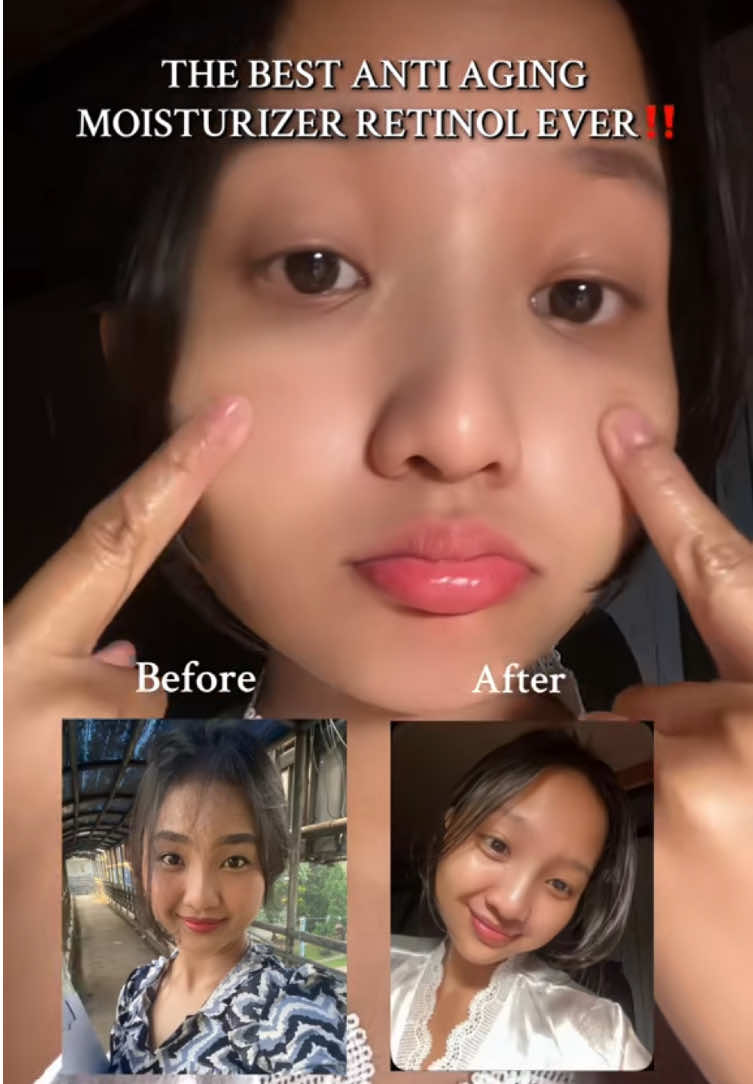 MOISTURIZER LAYAK VIRAL DI TAHUN 2025⁉️ @Lanbena.Indonesia  #lanbenaskincare #lanbenaretinol  #skincareroutine #skincareviral  #foryou  