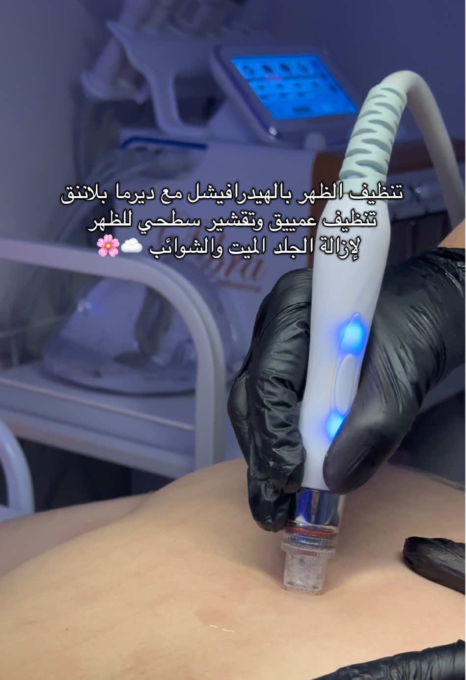 جلسة متكامله عنايه للظهر ☁️🌸 . للحجز و الاستفسار على الرقم  0554404934 . . #تغطيات_الرياض #سبا_الرياض #صالونات #اويا #اويا_سبا #اكسبلورexplore #تنظيف_الظهر #اماكن_الرياض #صالونات_الرياض 