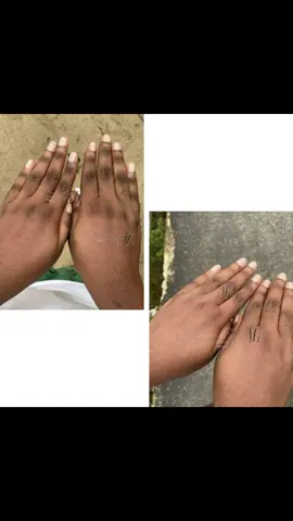 Et juste comme ça, ses quinto ont disparu.💃🏽💃🏽💃🏽 enlever les quintos noir rapidement quintos mains astuce pour les quintos comment enlever les quintos eliminer les quintos des mains comment enlever les quintos des mains comment traiter les quintos lady quintos Serum pour quintos comment enlever les quintos rapidement comment enlever le quintos produits pour les quintos astuces pour les quintos comment eliminer les quintos enlever les quintos crème pour les quintos #quinto #hyperpigmentation #tache #knucles #darkspots 