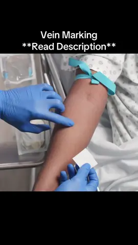 Vein marking techniques can be used for both IV insertion and phlebotomy. . An easy trick for any patient with deeper or less visible veins (other than simply choosing a landmark on the skin like a freckle, mole, scar or tattoo) is to place a sterile alcohol pad just above where you feel the vein best. Use the corners of the pad as a directional marker so you can line up your needle properly. Cleanse the site while holding the pad in place, then perform your venipuncture. . . You can also use a surgical skin marker, just make sure not to pierce through the marking. Place a dot above and below where you feel the vein best. This will give you an idea of which direction the vein is running. Insert your needle in between these two dots 😊 (there are more marking techniques in the IV Video Course too). . The IV Video Course is 30% off for a limited time (along with all my other courses!), and includes 2 hours of continuing education! If you want to learn everything you need to know about starting IVs, click the link in my profile or head to www.theivguy.com/courses to find out more. . #nurse #nursing #rn #rnlife #nurselife                         