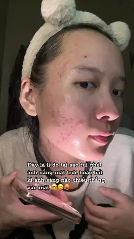 Sẹo mụn rất là khó điều trị 🥹#chamsocda #goclamdep #reviewlamdep #trimuntritham 