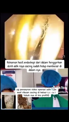 video cacing keluar dari dalam tubuh raya 😭 #fakesituation⚠️ #rayacacingdidalamtubuh #rayasukabumi 