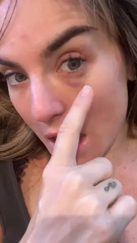 just GORGEOUS…  Any makeup/ concealer brands you recommend for this bruise?! 