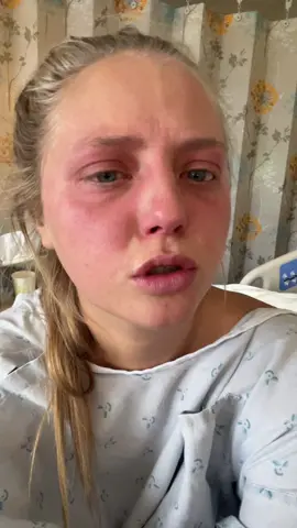 tbsfr #fyp #foryou #livertransplant #recovery #autoimmune 