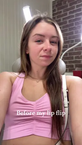 My lip flip results!! Thursday is my check up to make sure everything has taken right but so far i’m loving the lip flip!!🤩 #lipflip #lipflipresults 