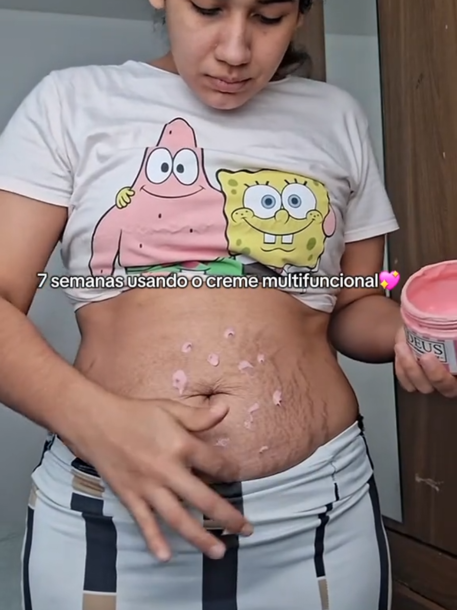 Amigas, o creme rosa é multifuncional, trata estrias celulite, foliculite, flacidez e reduz medidas. Melhor investimento após 2 gestação❤️ #lipedema #celulite #foliculite #estria #adeusfoliculite #adeusestria #adeuslipedema #adeuscelulite #cremerosa #gorduralocalizada #posparto #corpoposparto #cremerosa #autocuidado #foryou #foryoupage #estriasbrancas  #cuidadoscomapele #autocuidadofeminino 
