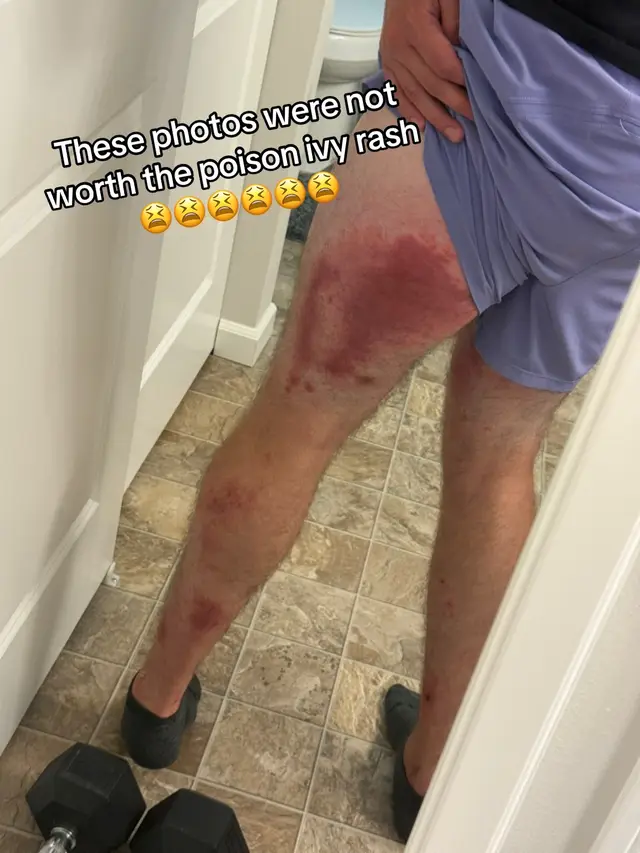 Went up on this hill side to get a better vantage point of cars coming across this bridge.. was totally fine for about a week then out of no where my legs started to itch severely and rashes started to form.. didn’t know poison ivy was so delayed 😭 pics were NOT worth it. 