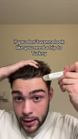 This thing will save a you a $10,000 Turkey trip                          #hair #haircare #balding 