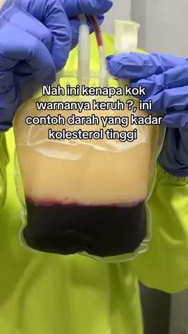 Jadi gitu ya wahai pendonor  #donordarah #tranfusidarah #plasma #kolesteroltinggi #kolesterol 