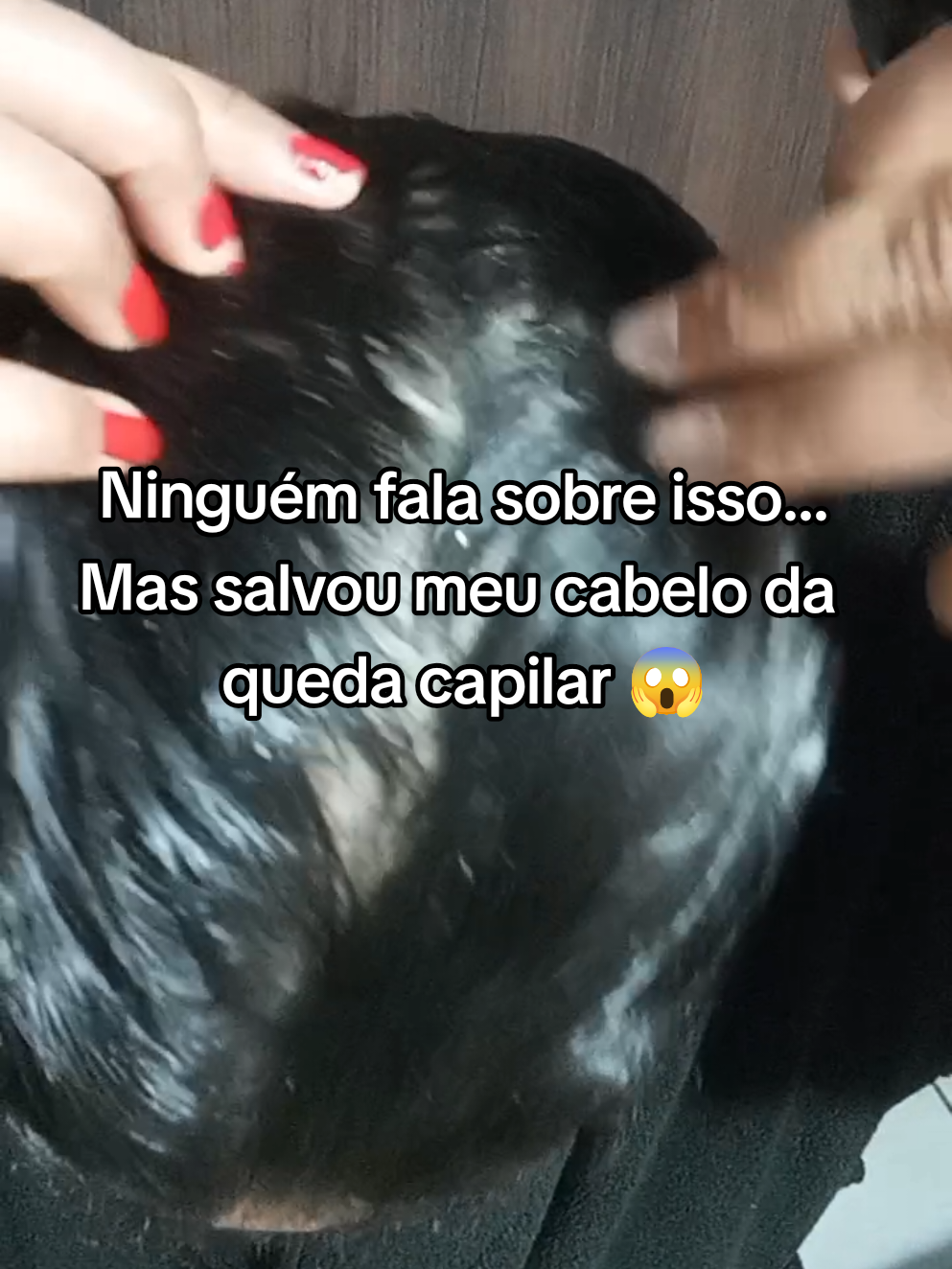 Antes vêm me acompanhar aqui amiga 🫶🫶 Esse tônico com Bioex e Biotina realmente ajudou a desinflamar o meu couro cabeludo e fortalecer a raiz do cabelo e trazer fios novos e saudáveis 🫶   #hairtok #quedacapilar #mulheres #cabelosaudavel #tonicocapilar #tratamentocapilar 