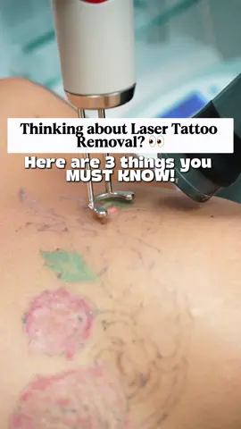 ✨ Thinking about laser tattoo removal? Here are the TOP 3 things you need to know before starting your journey: 1️⃣ It’s a process, not a one-time fix. 2️⃣ That white frost you see? It’s temporary, not your tattoo disappearing. 3️⃣ Aftercare is EVERYTHING — healing between sessions = better results. At BH Laser Tattoo Removal, we use advanced triple-wavelength technology to safely target all ink colors and deliver the best outcomes. 💫 📍 Fort Lauderdale & Miami Lakes 📲 Call/WhasApp: 954-368-3195 💻 Book online: bhlasertattooremoval.com #LaserTattooRemoval #BHlaser #FortLauderdale #MiamiLakes #tattooremoval 
