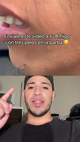 Envíale este video a tu amigo 🤫🤫 #beardserum #beardgrowthtips #beardgrowth 