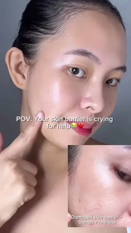 🚨 Damaged skin barrier alert 🚨 I had tiny bumps + redness all over 😩 but after just 7 days, my skin started to glow again! All thanks to the #Zipiderm EGF Skin Barrier Cream Toner🥹😍 ✔️ Calmed my redness ✔️ Smoothed out those bumps ✔️ Deeply hydrated & repaired my barrier 4.8x faster! Now my skin feels plump, healthy, and glowing 💯 Trust me, if your barrier needs saving, this is IT. 🙌 You can buy it on Amazon! @zipiderm_global @zipiderm_official Thank you @chuachinlie on IG 🤍 #celltrionskincure #zipiderm #egfskinbarrier #egfcreamtoner       