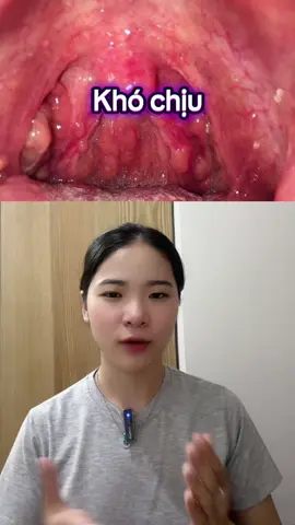 Nước súc miệng dành cho người bị Viêm họng hạt#nhathuocnph01 #viemhonghat #hatlympho #nsmhupavir #hupavir 